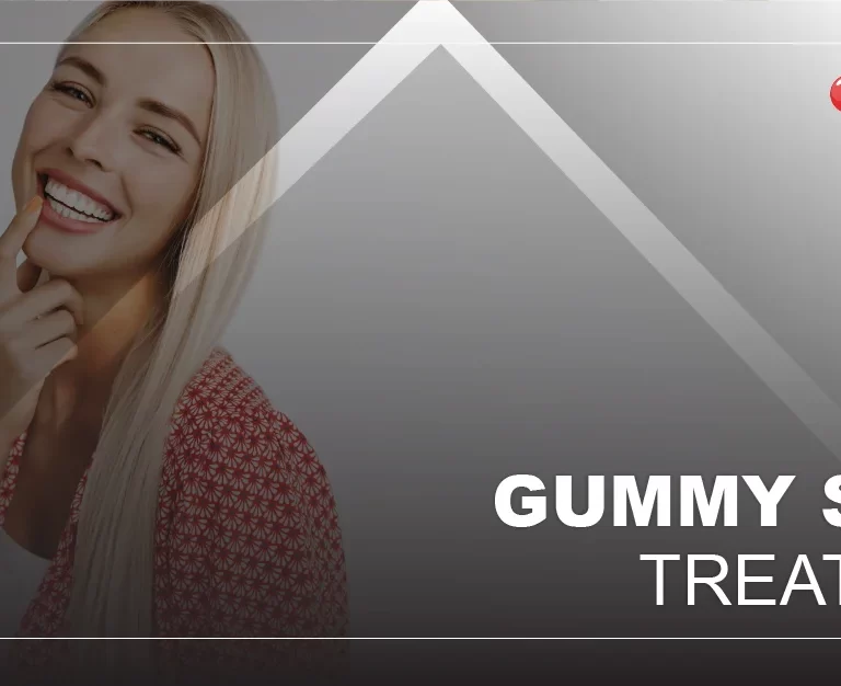 gummy-smile-treatment