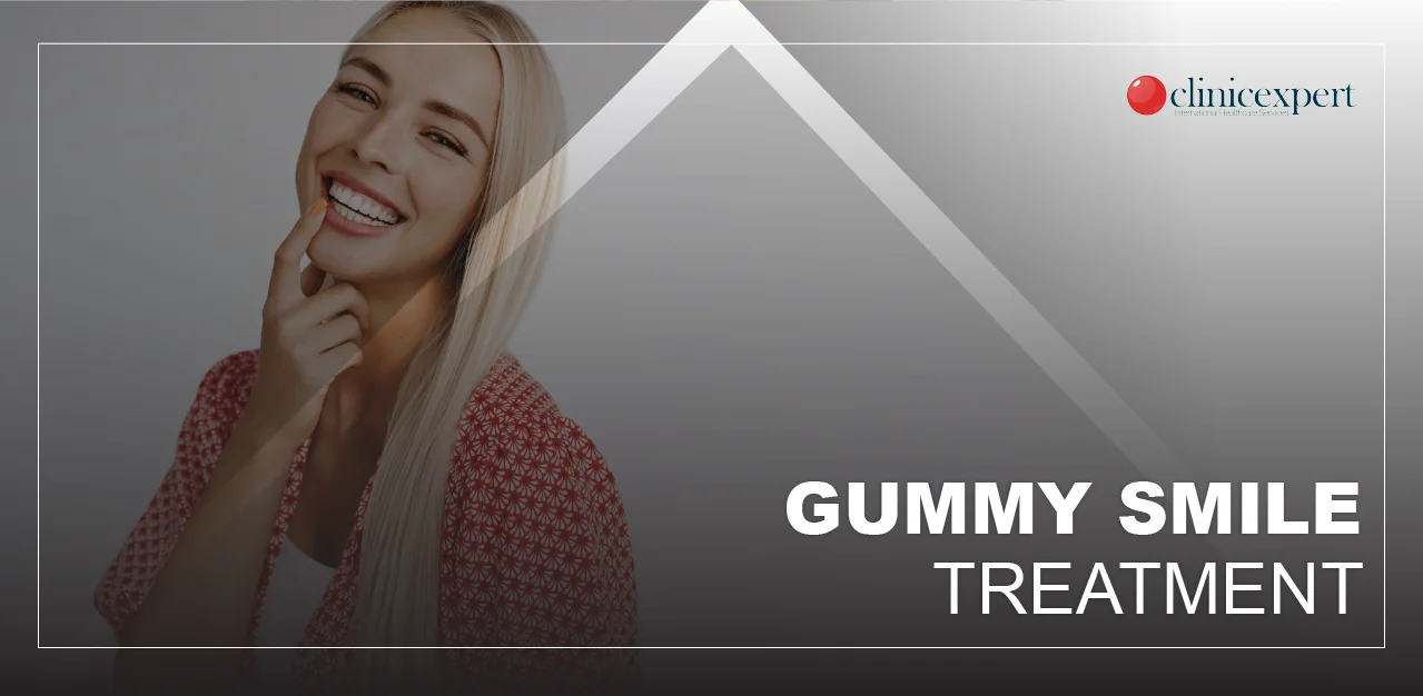 gummy-smile-treatment