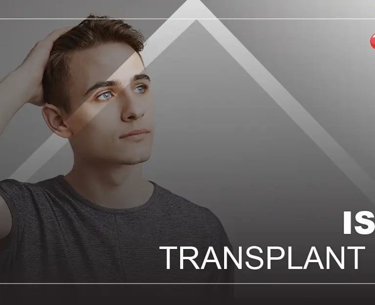 Is-hair-transplant-safe