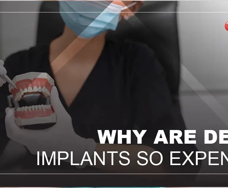 Why are dental implants so expensive?