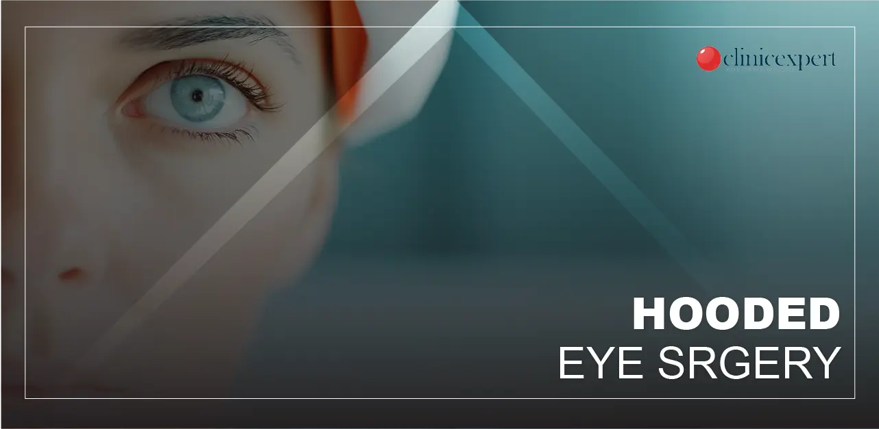 hooded eye surgery
