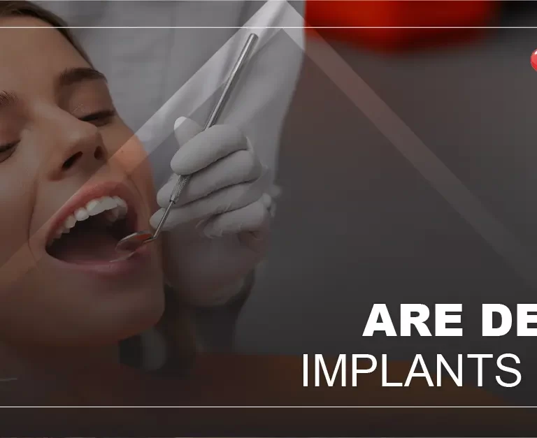 Are Dental Implants Safe?