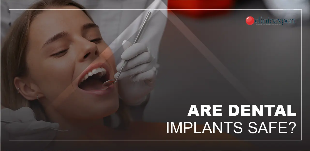 Are Dental Implants Safe?