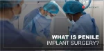 WHAT IS PENILE IMPLANT SURGERY