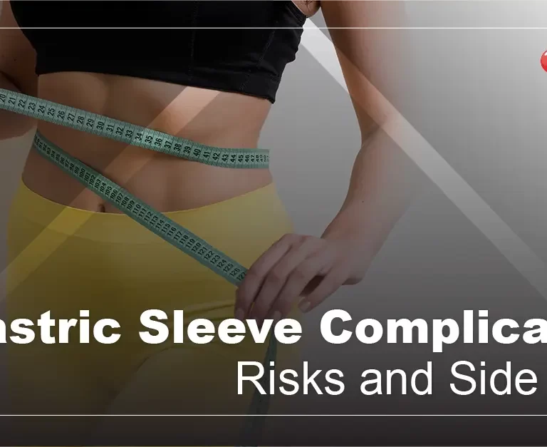 Gastric Sleeve Complications: Risks and Side Effects