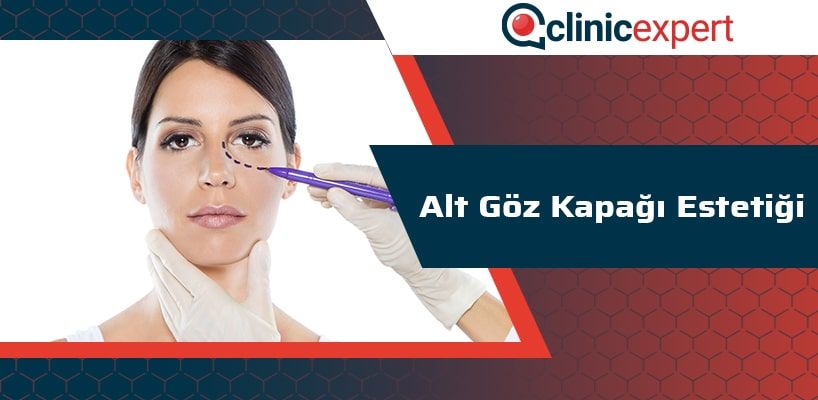 Alt Göz Kapağı Estetiği