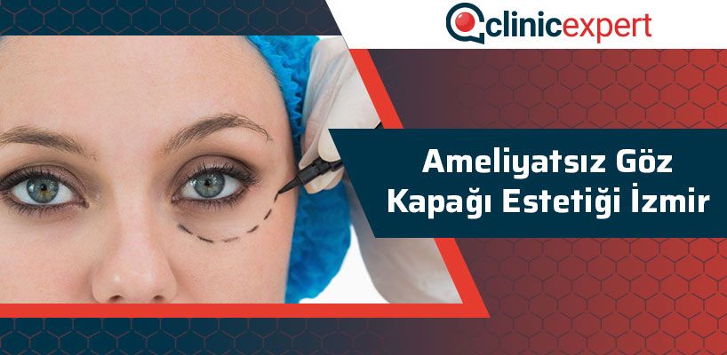 Ameliyatsız Göz Kapağı Estetiği İzmir