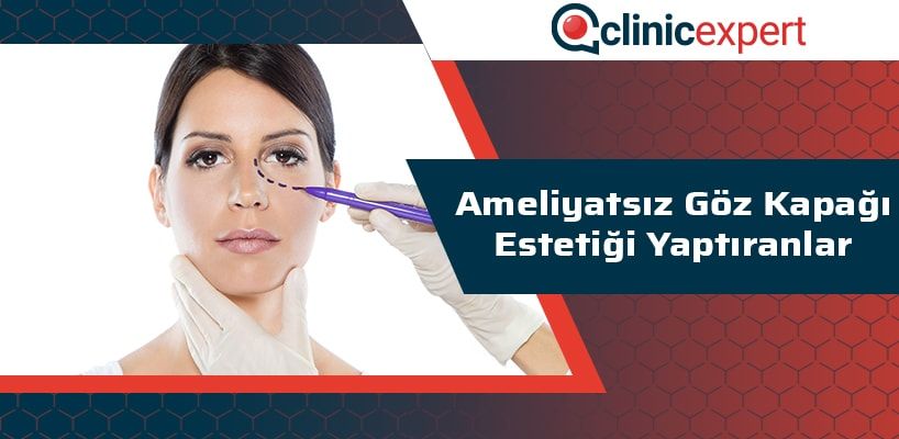 ameliyatsiz-goz-kapagi-estetigi-yaptiranlar-cln-min