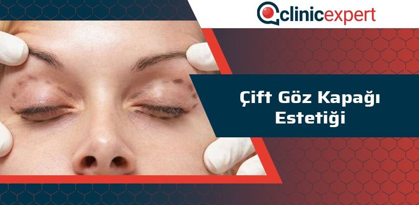 cift-goz-kapagi-estetigi-cln-min