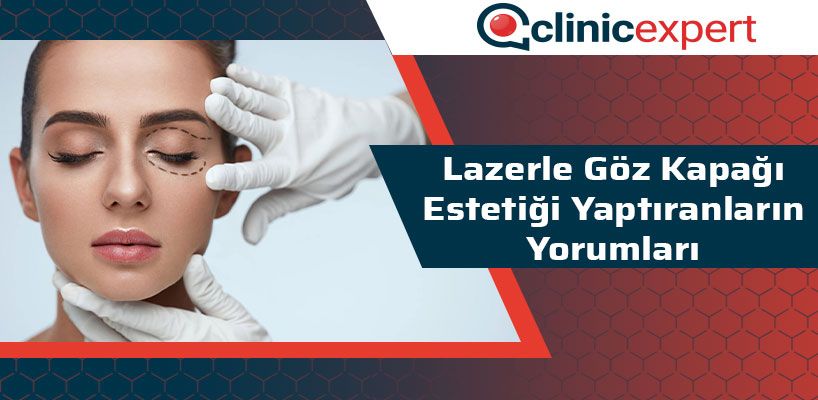 lazerle-goz-kapagi-estetigi-yaptiranlarin-yorumlari-cln