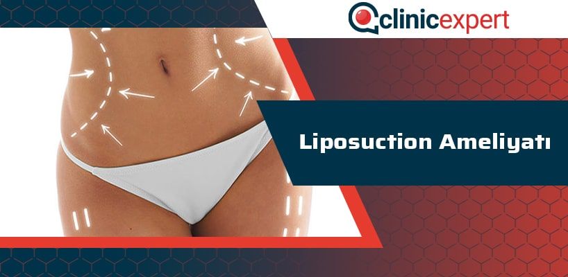 liposuction-ameliyati-cln-min