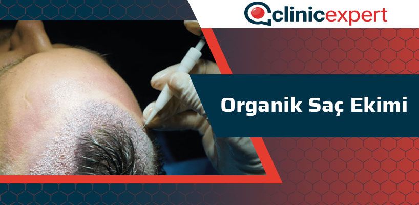 Organik Sac Ekimi Clinic Expert