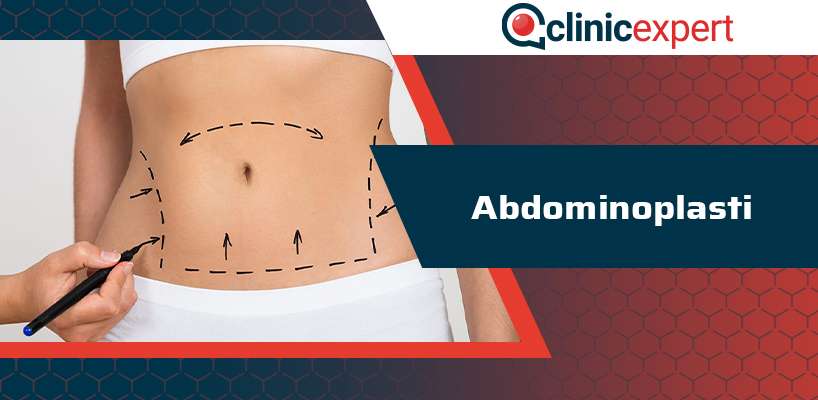 abdominoplasti-cln