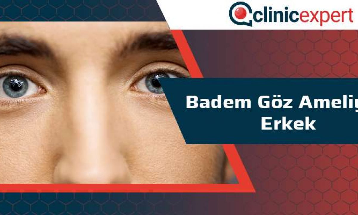 Badem Goz Ameliyati Erkek Clinicexpert Uluslararasi Saglik Hizmetleri