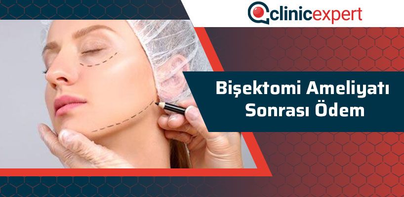 Bişektomi Ameliyatı Sonrası Ödem Olur Mu?