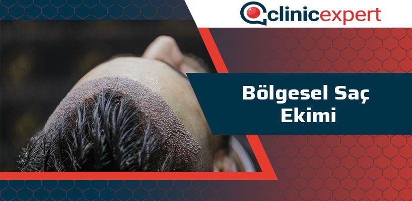 bolgesel-sac-ekimi-nedir-cln