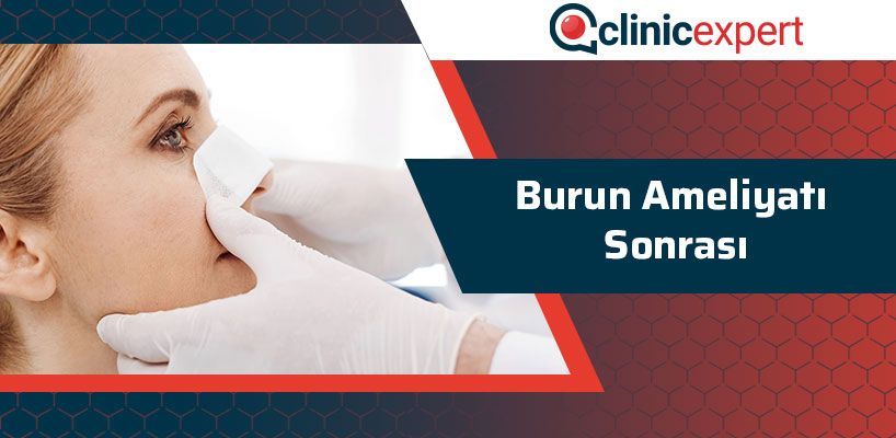 Burun Ameliyatı Sonrası