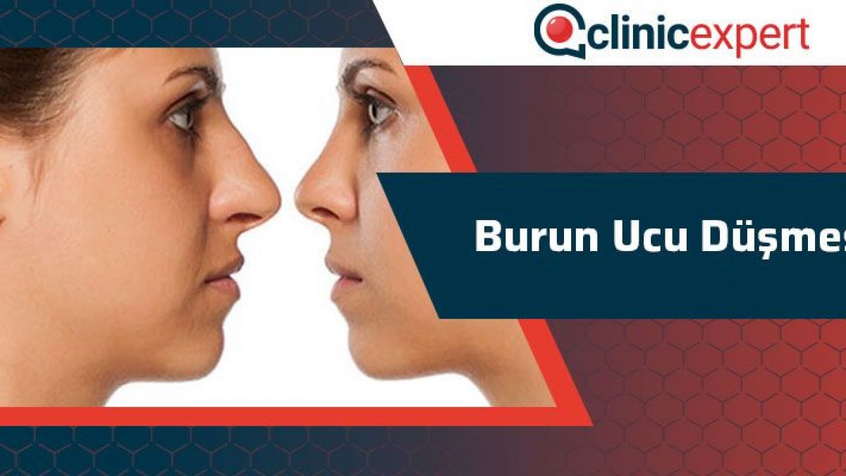 burun ucu dusmesi clinic expert