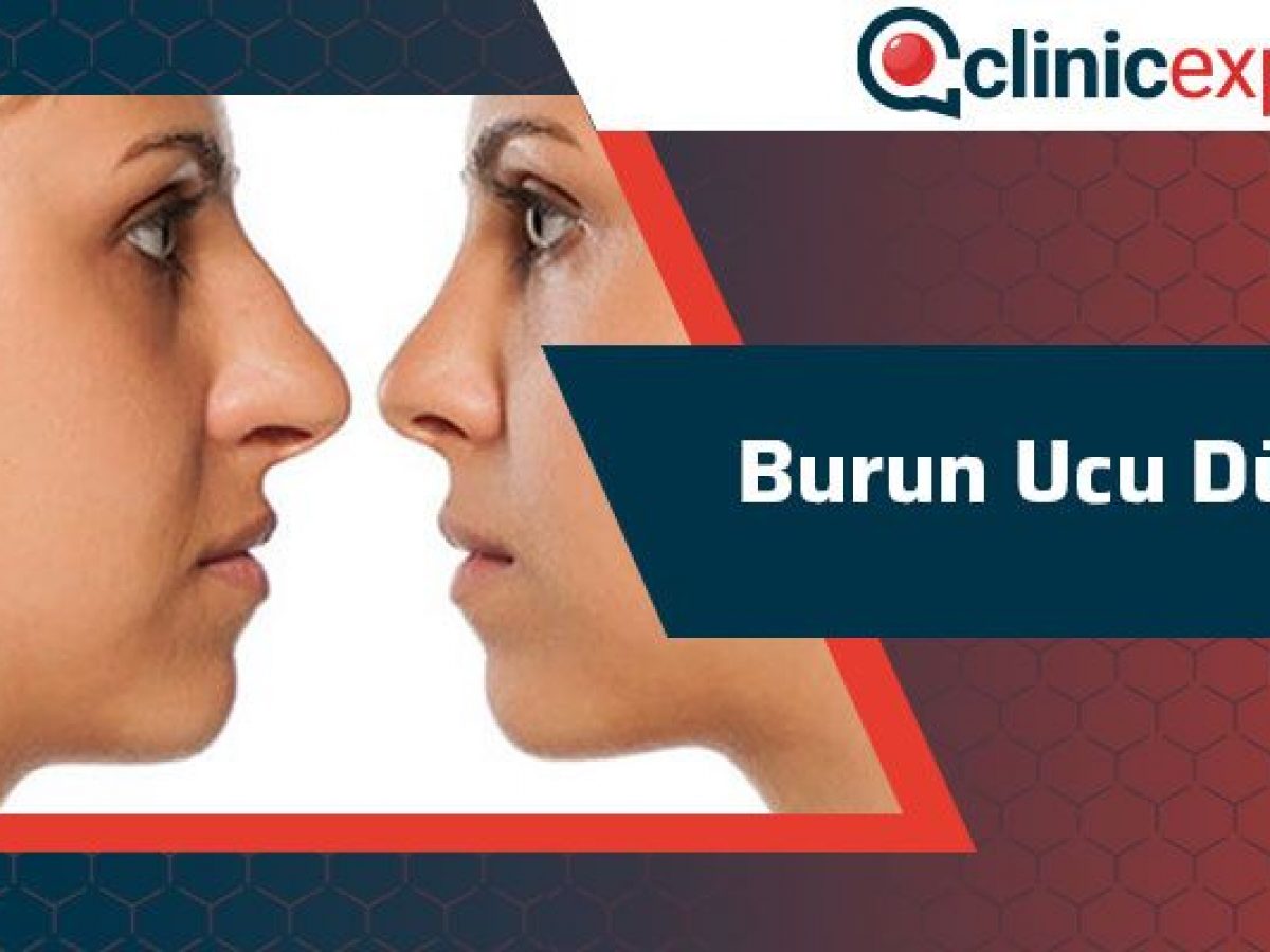 burun ucu dusmesi clinic expert