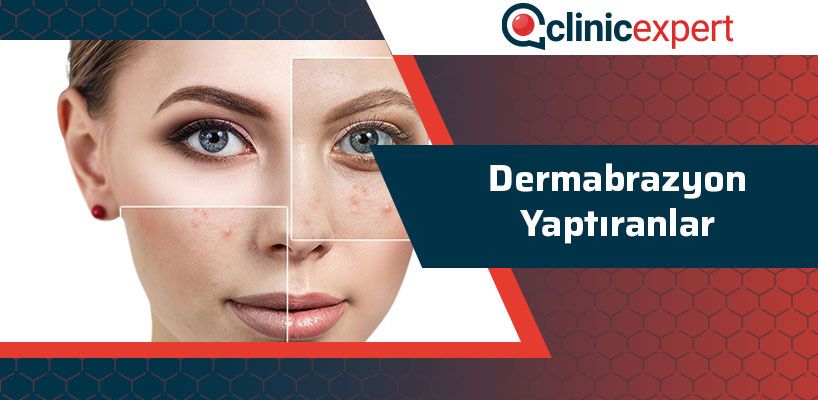 dermabrazyon-yaptiranlar-cln