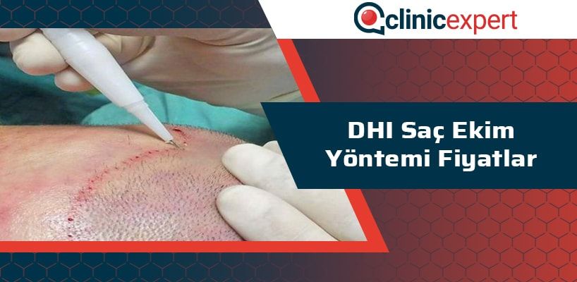 dhi-sac-ekim-yontemi-fiyatlar-cln-min