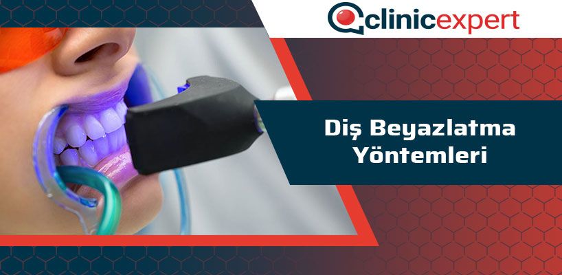 dis-beyazlatma-yontemleri-cln