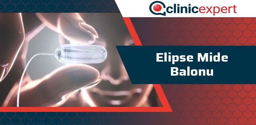 elipse-mide-balonu-cln