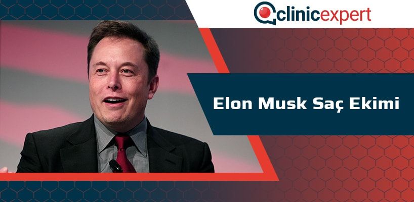 elon-musk-sac-ekimi-cln-min