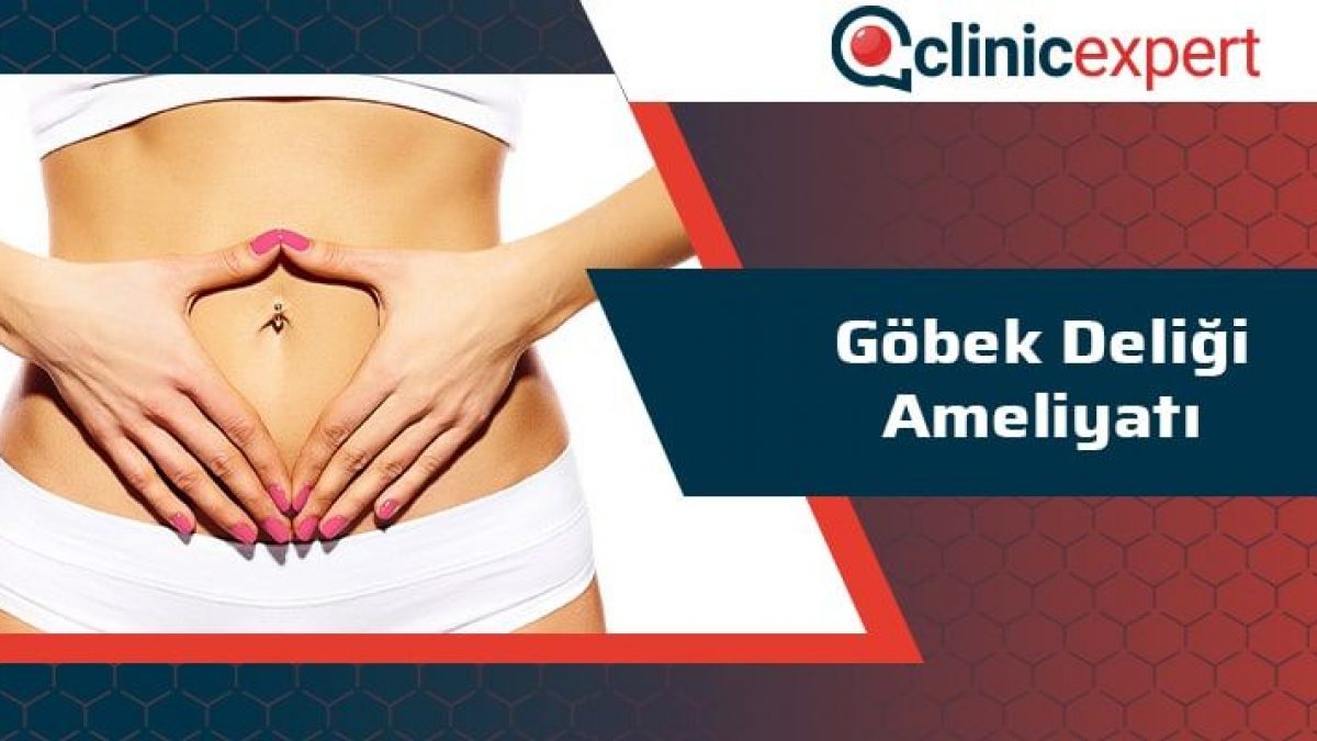 gobek deligi ameliyati clinic expert