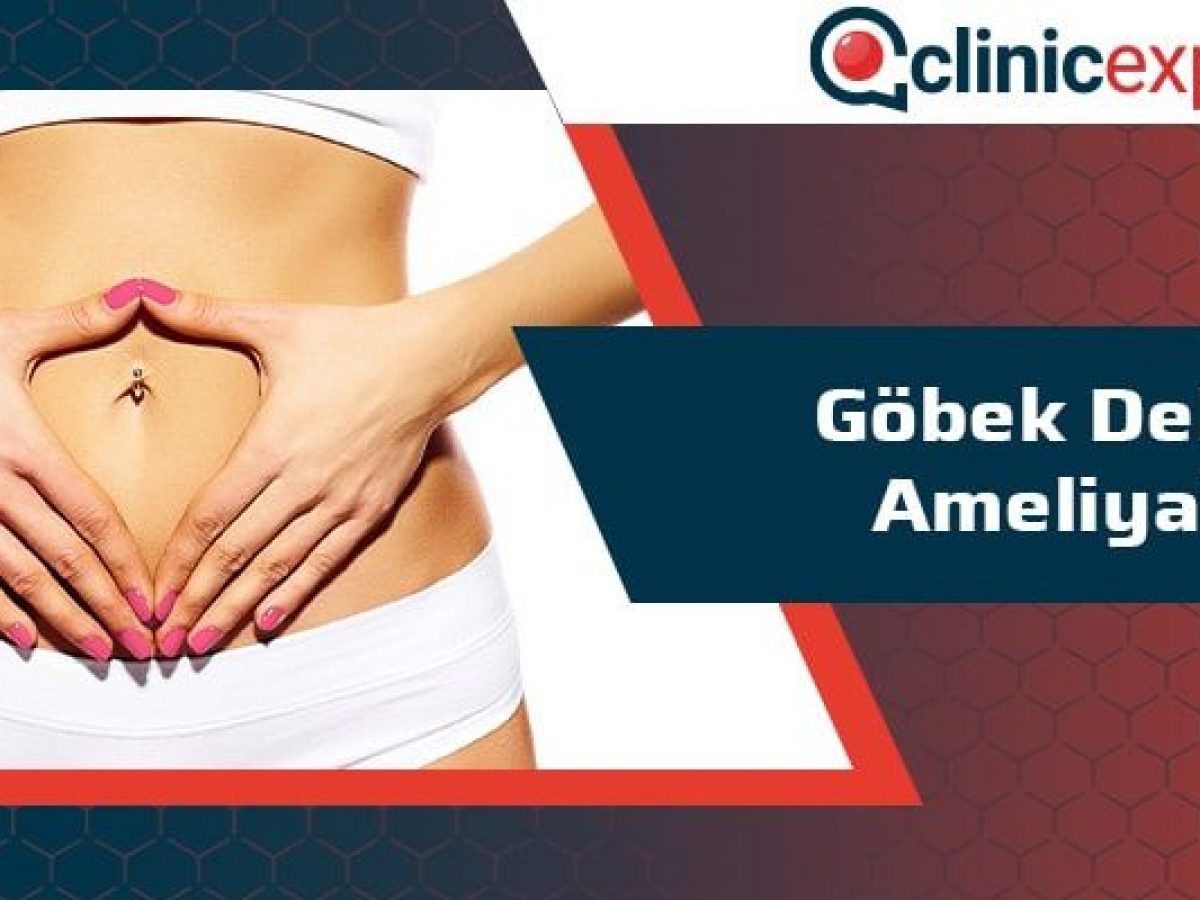 gobek deligi ameliyati clinic expert