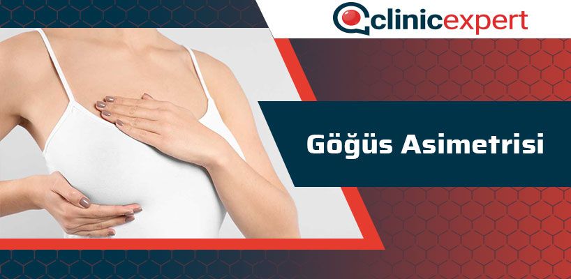 gogus-asimetrisi-cln