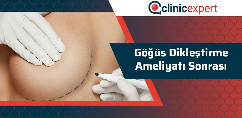 gogus-diklestirme-ameliyati-sonrasi-cln