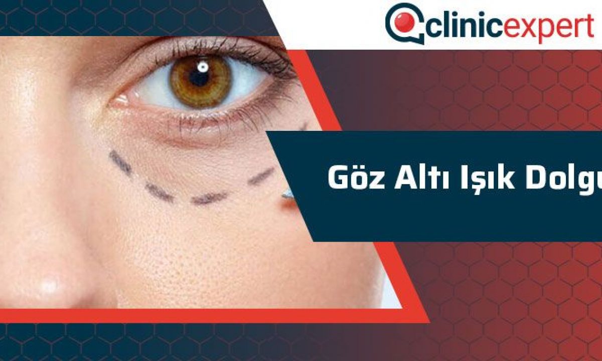 Goz Alti Isik Dolgusu Nedir Clinicexpert Uluslararasi Saglik Hizmetleri