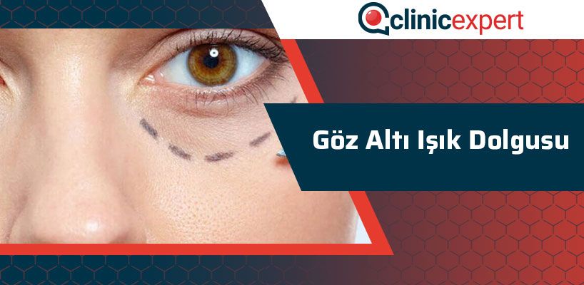 goz-alti-isik-dolgusu-2-cln