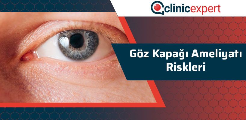Göz Kapağı Ameliyatı Riskleri
