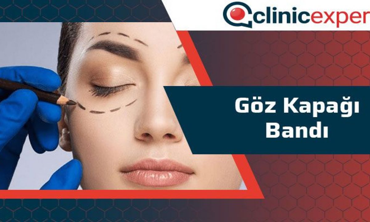 Goz Kapagi Bandi Nedir Clinic Expert