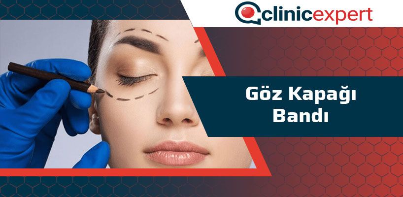 Goz Kapagi Bandi Nedir Clinic Expert