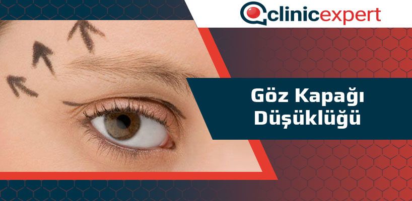 Göz Kapağı Düşüklüğü