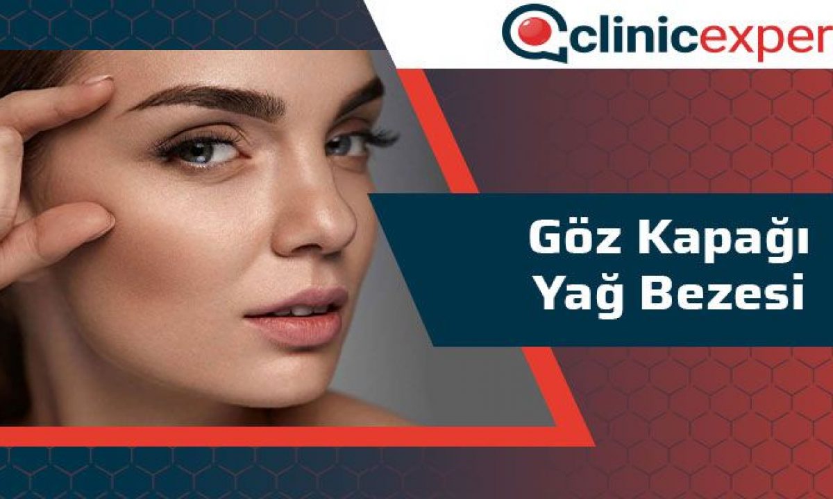 Goz Kapagi Yag Bezesi Clinic Expert