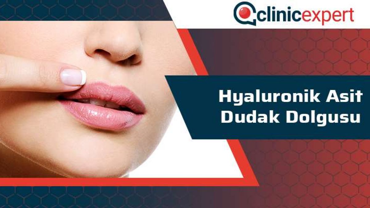 hyaluronik asit dudak dolgusu clinicexpert uluslararasi saglik hizmetleri