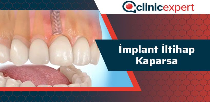 implant-iltihap-kaparsa-cln