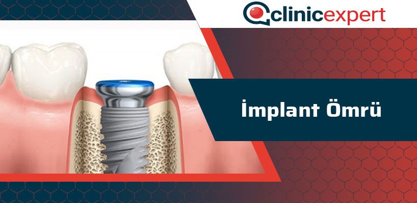 implant-omru-cln