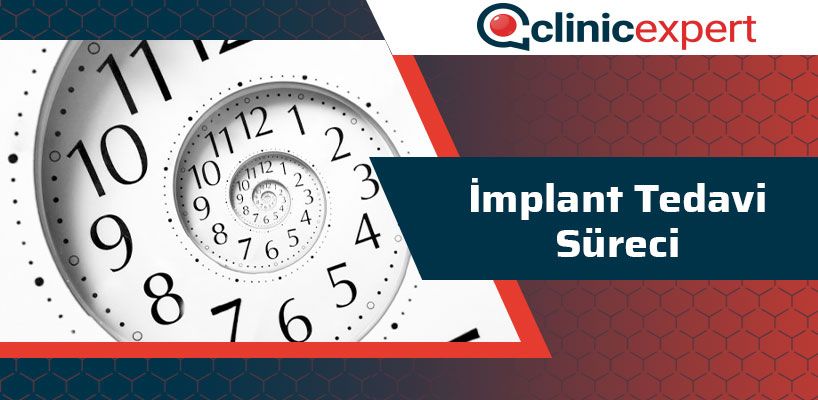 implant-tedavi-sureci-cln