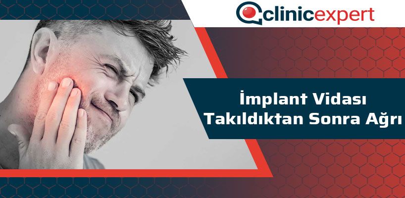 İmplant Vidası Takıldıktan Sonra Ağrı