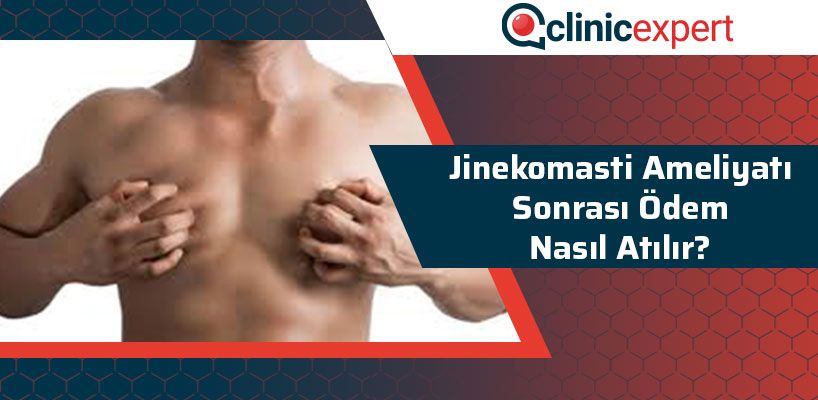 Jinekomasti Ameliyatı Sonrası Ödem Nasıl Atılır?