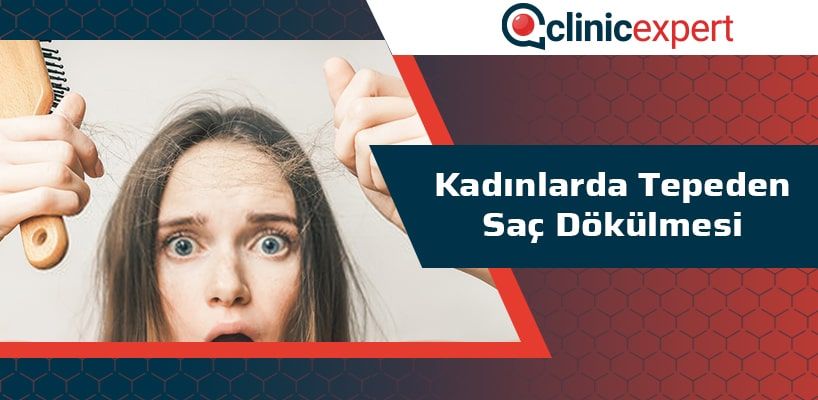 kadinlarda-tepeden-sac-dokulmesi-cln-min