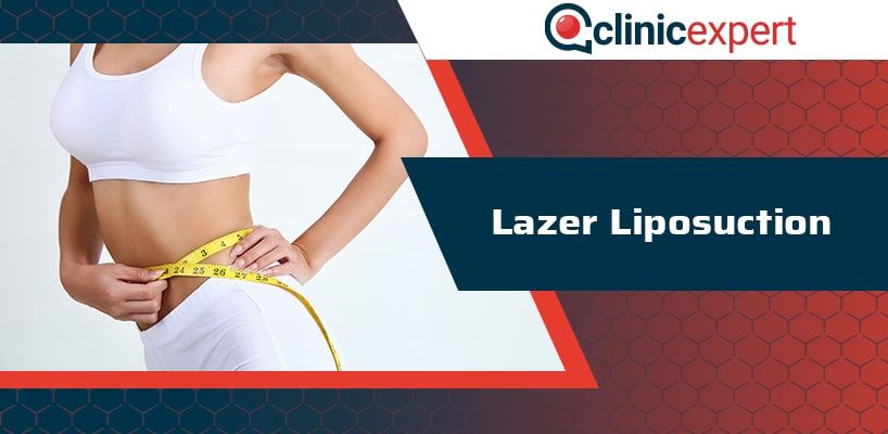 lazer-liposuction-cln-min