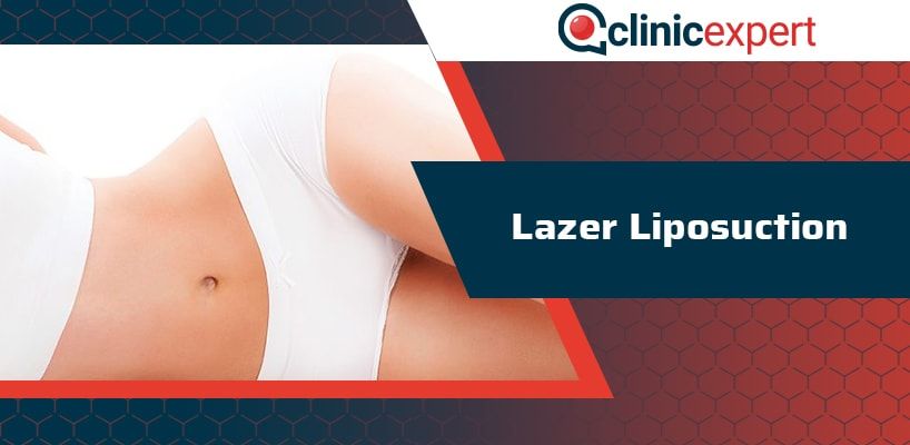 lazer-liposuction-cln-min