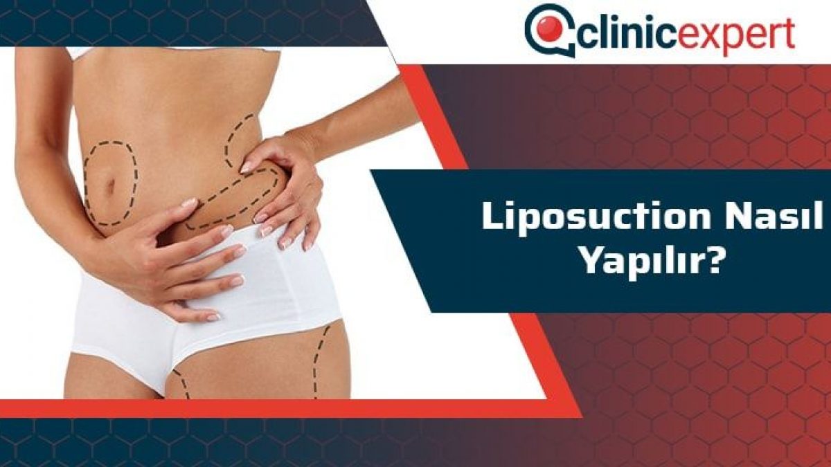 Liposuction in Turkey