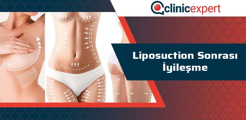 liposuction-sonrasi-iyilesme-cln-min